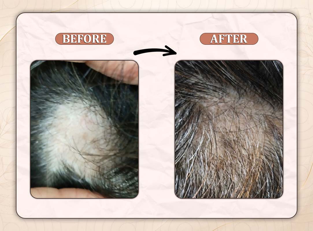 Treatment Result 1