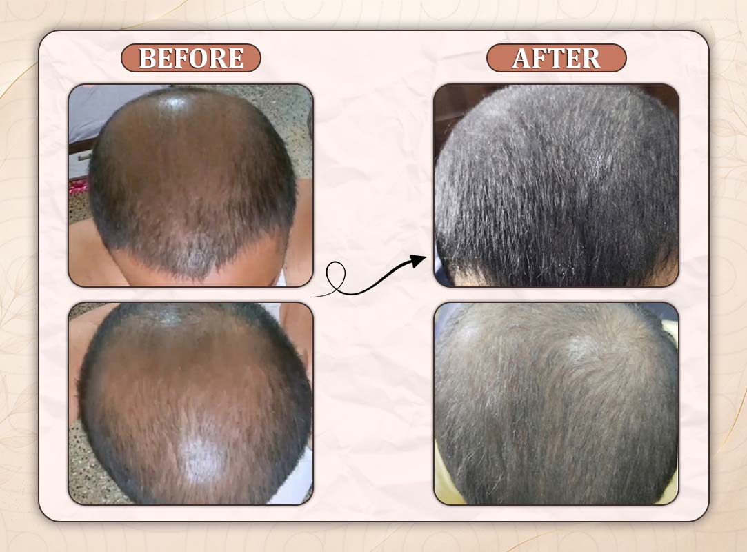 Treatment Result 10