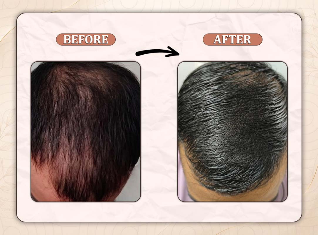 Treatment Result 12