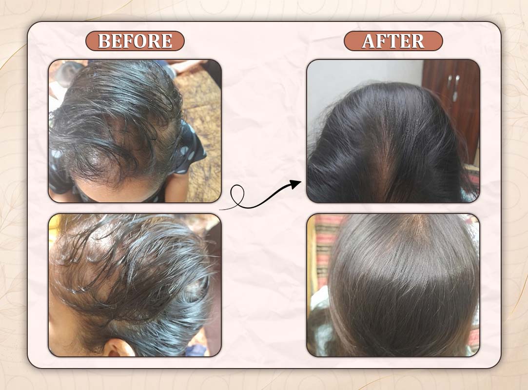 Treatment Result 13