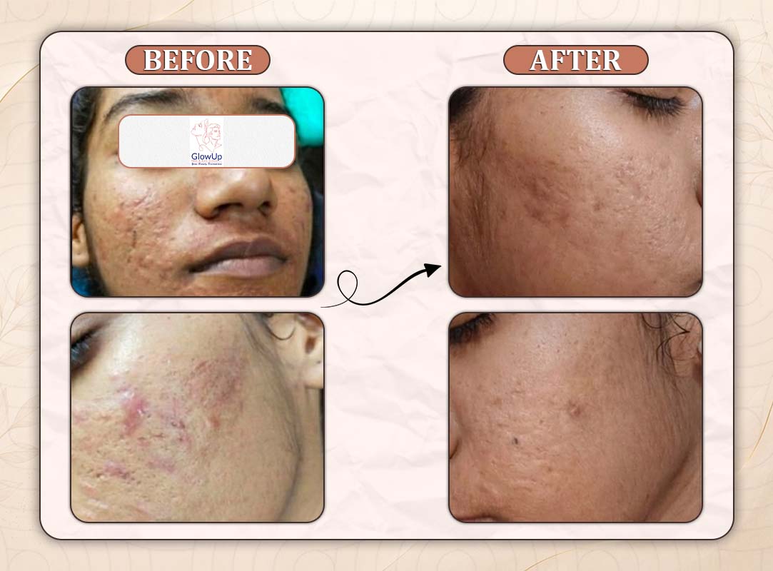 Treatment Result 15