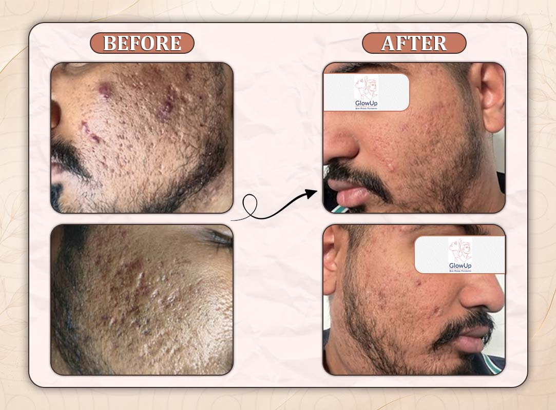 Treatment Result 16