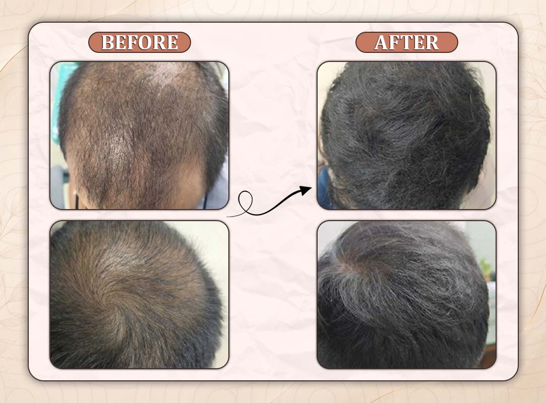 Treatment Result 17