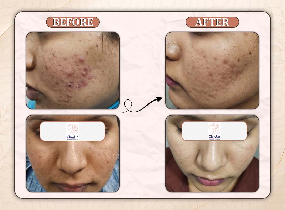 Treatment Result 18