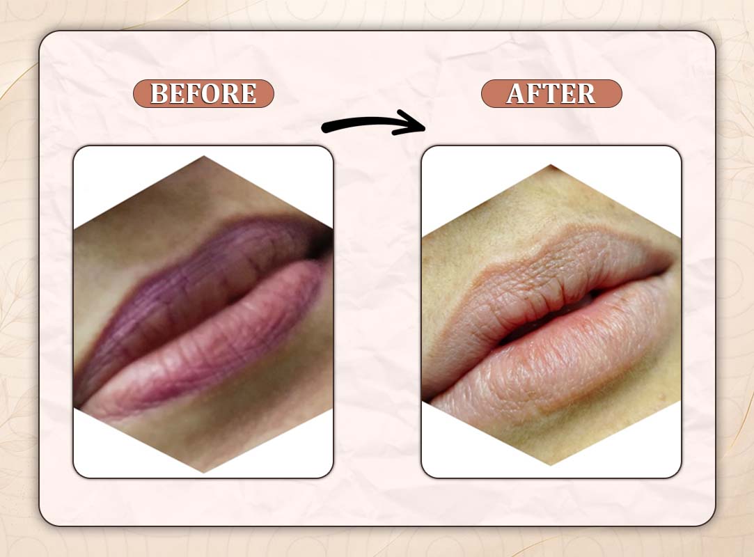 Treatment Result 2