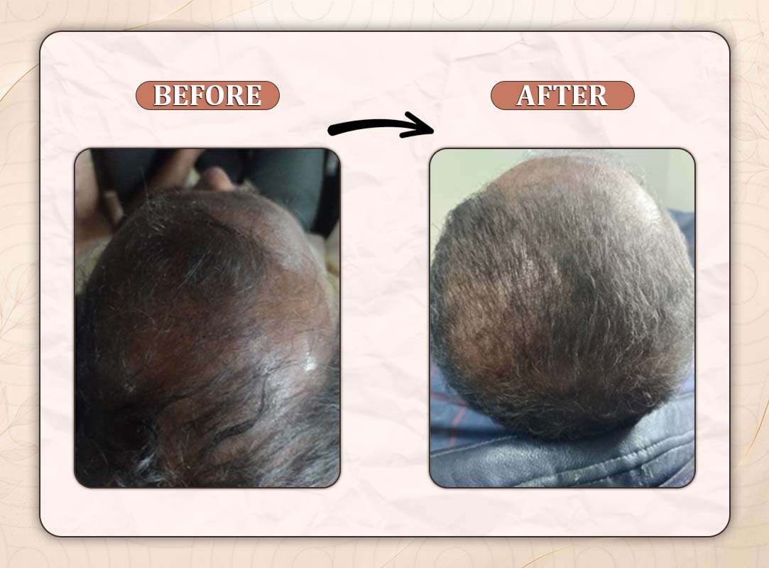 Treatment Result 3