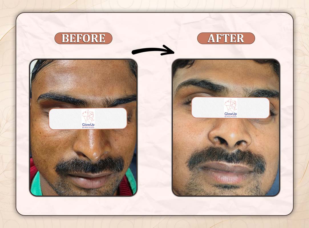 Treatment Result 4