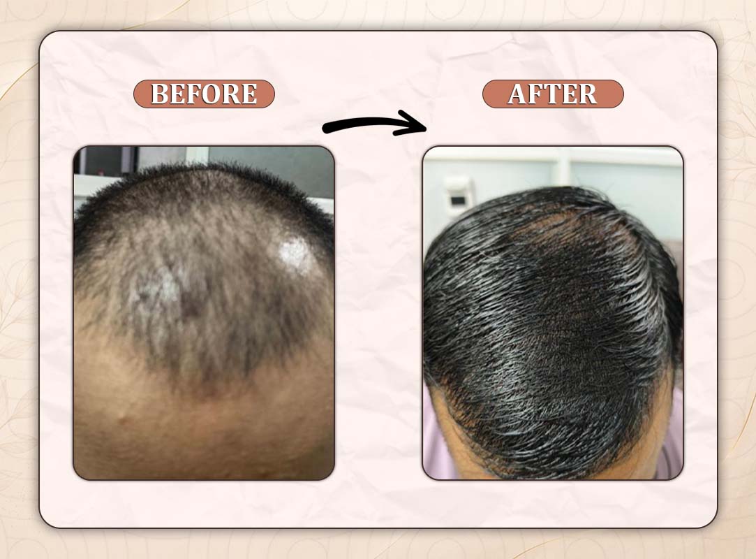 Treatment Result 5