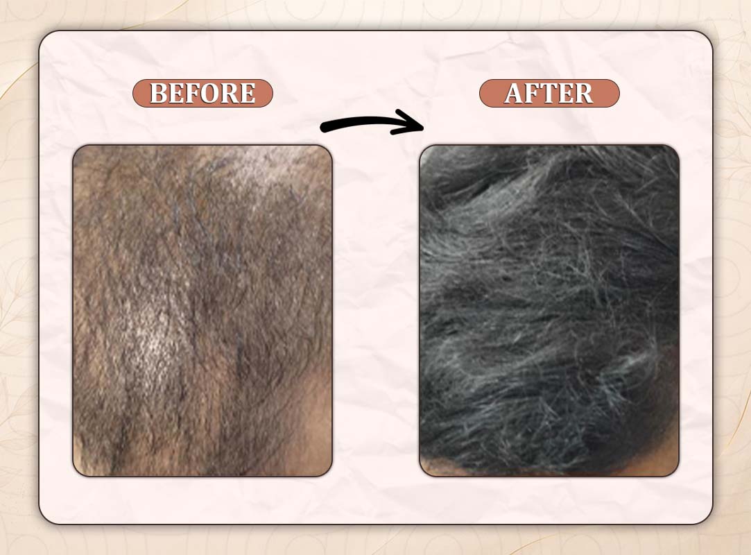 Treatment Result 6