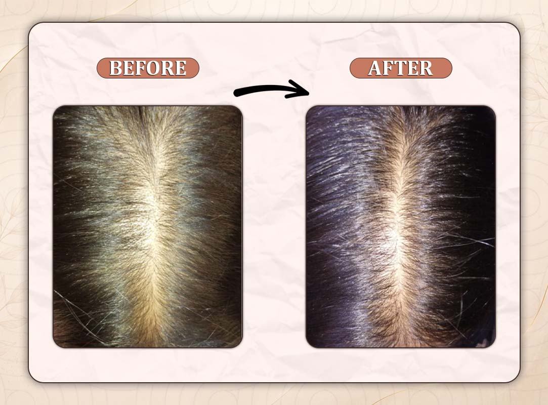 Treatment Result 7