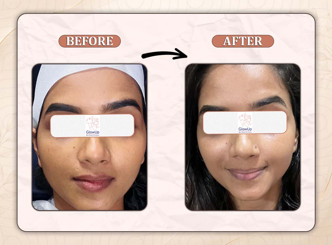 Treatment Result 8