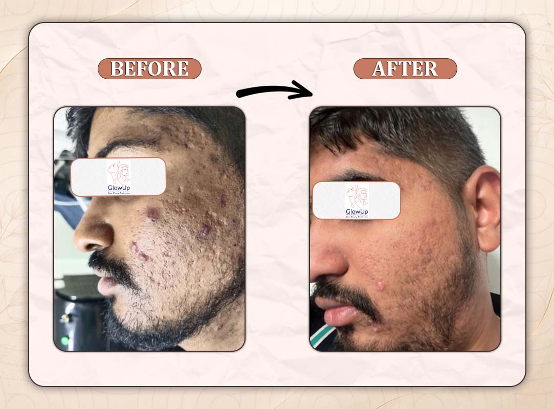 Treatment Result 9